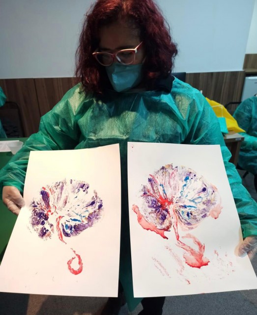 Print de Placenta: oficina prepara equipe do Hospital Albert Sabin para eternizar as lembranças do parto através da arte